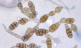 Salud Relevan en aserraderos hongos causantes de algunas patologías La alternaria spp es uno de los hongos aereos al que están expuestos los trabajadores en aserraderos