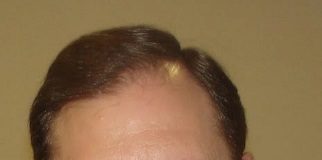 Graduados Separación de siameses: una hazaña con aporte de un médico que se recibió en la UNNE El médico Sergio Paikovsky graduado de la UNNE coordinó el equipo profesional que pudo separar siameses