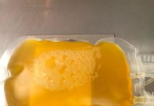 COVID-19 Ensayos clínicos demostraron que el plasma no es efectivo en pacientes graves