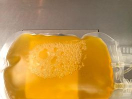 Ensayos clínicos demostraron que el plasma no es efectivo en pacientes graves