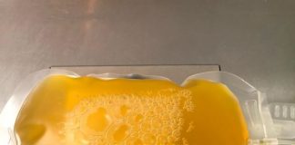 COVID-19 Ensayos clínicos demostraron que el plasma no es efectivo en pacientes graves