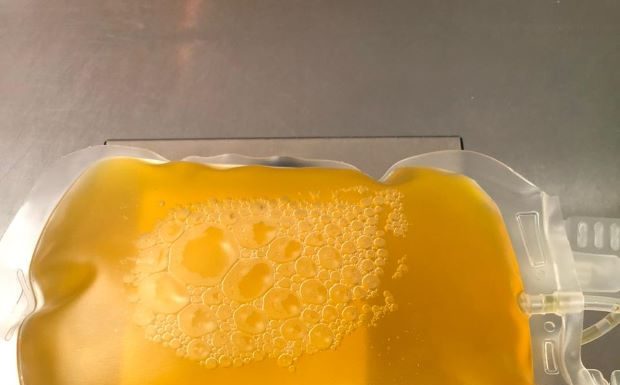 COVID-19 Ensayos clínicos demostraron que el plasma no es efectivo en pacientes graves