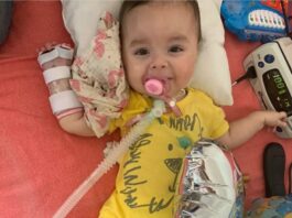 Emma, la beba que tiene AME y requiere el medicamento más caro del mundo