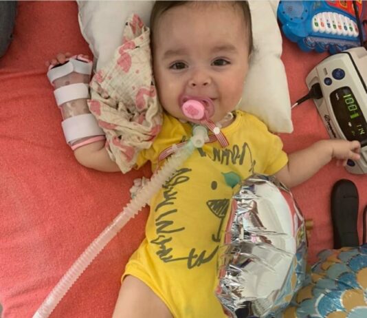 Emma, la beba que tiene AME y requiere el medicamento más caro del mundo