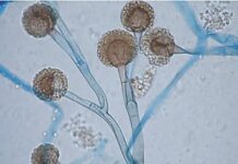 Entrevista Mucormicosis: el hongo que afecta a pacientes con enfermedades de base o con baja inmunidad Imagen de un hongo mucoral