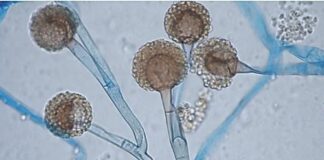 Entrevista Mucormicosis: el hongo que afecta a pacientes con enfermedades de base o con baja inmunidad Imagen de un hongo mucoral