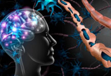 Especialista de la UNNE participó en elaboración de consenso para optimizar tratamiento de la Esclerosis Múltiple Secundaria Progresiva