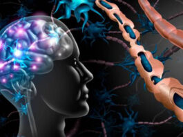 Especialista de la UNNE participó en elaboración de consenso para optimizar tratamiento de la Esclerosis Múltiple Secundaria Progresiva