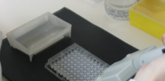 CON INSTITUTO MALBRAN Validan técnicas utilizadas en el Instituto de Medicina Regional para detección de Toxocariosis humana