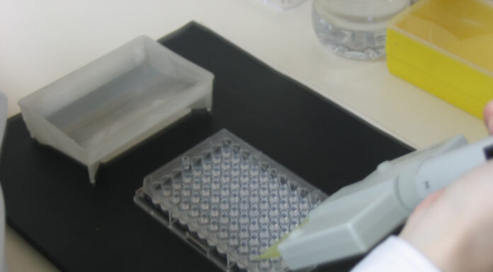 CON INSTITUTO MALBRAN Validan técnicas utilizadas en el Instituto de Medicina Regional para detección de Toxocariosis humana