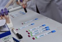 EXTENSIÓN Campaña de Testeos Voluntarios en FaCENA