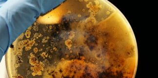 Entrevista Las superbacterias toman protagonismo ante la progresiva ineficacia de los antibióticos