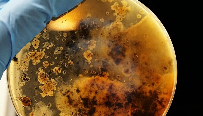 Entrevista Las superbacterias toman protagonismo ante la progresiva ineficacia de los antibióticos