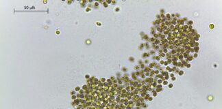 EL TEMA ES OBJETO DE ESTUDIO EN LA UNNE Cianobacterias potencialmente tóxicas, los microorganismos que hace casi dos décadas “colorean” aguas de la región Cianobacterias Microcystis aeruginosa.