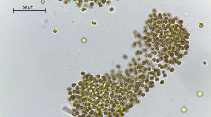 EL TEMA ES OBJETO DE ESTUDIO EN LA UNNE Cianobacterias potencialmente tóxicas, los microorganismos que hace casi dos décadas “colorean” aguas de la región Cianobacterias Microcystis aeruginosa.