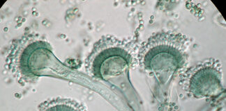 Identifican incidencia de la micosis «aspergilosis pulmonar» en 10% de pacientes críticos con COVID