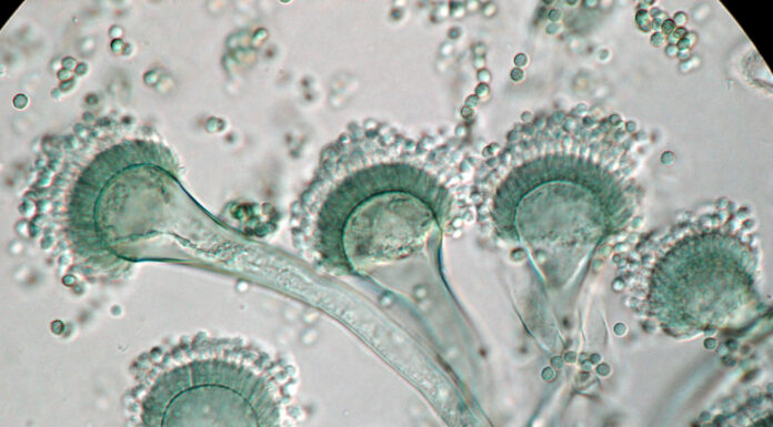 Identifican incidencia de la micosis «aspergilosis pulmonar» en 10% de pacientes críticos con COVID