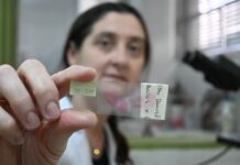 IMPORTANTES HALLAZGOS Identifican una proteína con potencial terapéutico y marcadora del pronóstico del cáncer renal más prevalente