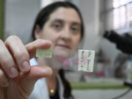 Identifican una proteína con potencial terapéutico y marcadora del pronóstico del cáncer renal más prevalente