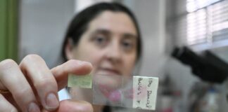 IMPORTANTES HALLAZGOS Identifican una proteína con potencial terapéutico y marcadora del pronóstico del cáncer renal más prevalente
