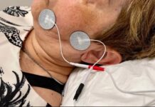 Confirman que la electroestimulación muscular reduce el tiempo de recuperación en casos de parálisis facial