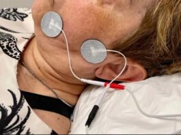 Confirman que la electroestimulación muscular reduce el tiempo de recuperación en casos de parálisis facial