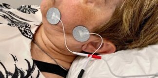 NUEVOS CONOCIMIENTOS Confirman que la electroestimulación muscular reduce el tiempo de recuperación en casos de parálisis facial