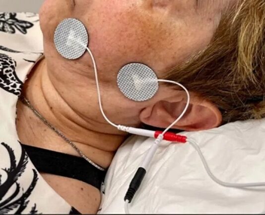 Confirman que la electroestimulación muscular reduce el tiempo de recuperación en casos de parálisis facial