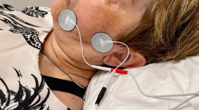 Confirman que la electroestimulación muscular reduce el tiempo de recuperación en casos de parálisis facial
