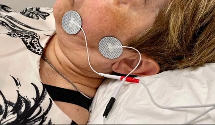 Confirman que la electroestimulación muscular reduce el tiempo de recuperación en casos de parálisis facial