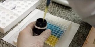 Evalúan en miembros de la UNNE la respuesta inmune frente a la vacunación y a la infección viral por SARS-CoV-2