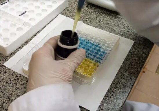 Evalúan en miembros de la UNNE la respuesta inmune frente a la vacunación y a la infección viral por SARS-CoV-2