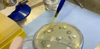 AJUSTAN TÉCNICAS DE DETECCIÓN Comprueban actividad antimicrobiana de extractos acuosos de yerba mate