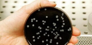 Legionella: hace casi una década la UNNE viene planteando la necesidad de estudios epidemiológicos