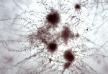 MIRADA CIENTÍFICA DESDE LA LENTE Concurso de Fotografía Microbiológica 2025: conocé a los ganadores