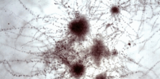 MIRADA CIENTÍFICA DESDE LA LENTE Concurso de Fotografía Microbiológica 2025: conocé a los ganadores