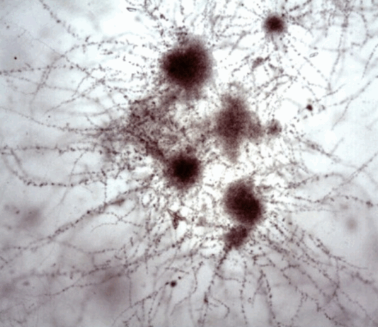 Concurso de Fotografía Microbiológica 2025: conocé a los ganadores