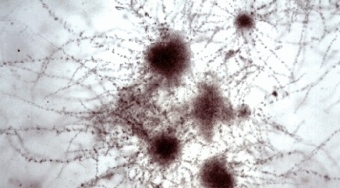 MIRADA CIENTÍFICA DESDE LA LENTE Concurso de Fotografía Microbiológica 2025: conocé a los ganadores