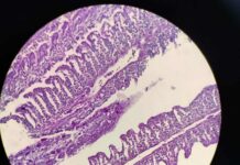 Becaria estudia lesiones branquiales en peces usados como carnada viva en el NEA