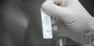 INSTITUTO DE MEDICINA REGIONAL Desarrollan prueba molecular portátil para la detección de una micosis endémica del norte argentino