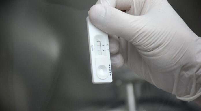 INSTITUTO DE MEDICINA REGIONAL Desarrollan prueba molecular portátil para la detección de una micosis endémica del norte argentino