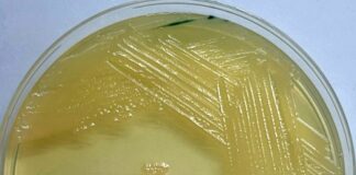 Nuevos Conocimientos Una nueva generación de antibióticos se alista para combatir a las superbacterias