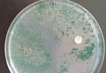 NUEVOS CONOCIMIENTOS Una técnica natural con hongos “protectores” podría impulsar el cultivo del Caupí