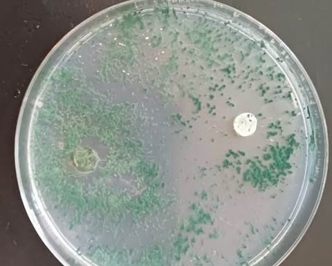 NUEVOS CONOCIMIENTOS Una técnica natural con hongos “protectores” podría impulsar el cultivo del Caupí