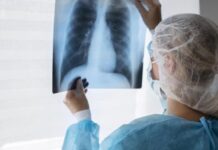 LOS CASOS SE INCREMENTARON EN UN 65% EN CINCO AÑOS Alerta sanitaria nacional: «Hay un aumento de la  tuberculosis en las poblaciones vulnerables”