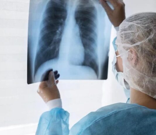 Alerta sanitaria nacional: «Hay un aumento de la tuberculosis en las poblaciones vulnerables”