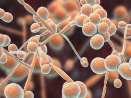La presencia de un hongo en el organismo induciría al Alzheimer y a otras enfermedades neurodegenerativas