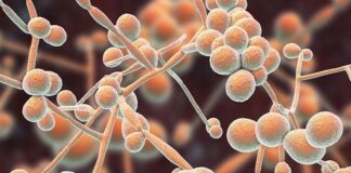 Nuevos Conocimientos La presencia de un hongo en el organismo induciría al Alzheimer y a otras enfermedades neurodegenerativas