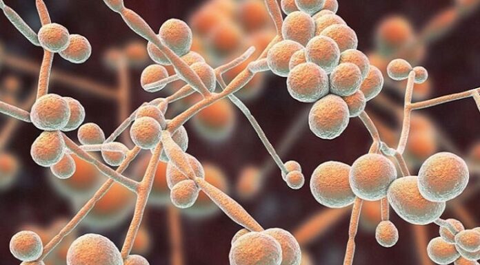 Nuevos Conocimientos La presencia de un hongo en el organismo induciría al Alzheimer y a otras enfermedades neurodegenerativas