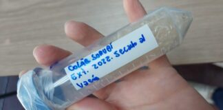 BIOTECNOLOGÍA De desecho a recurso: obtienen hidrolizado de colágeno de la piel de surubí e identifican su actividad antioxidante